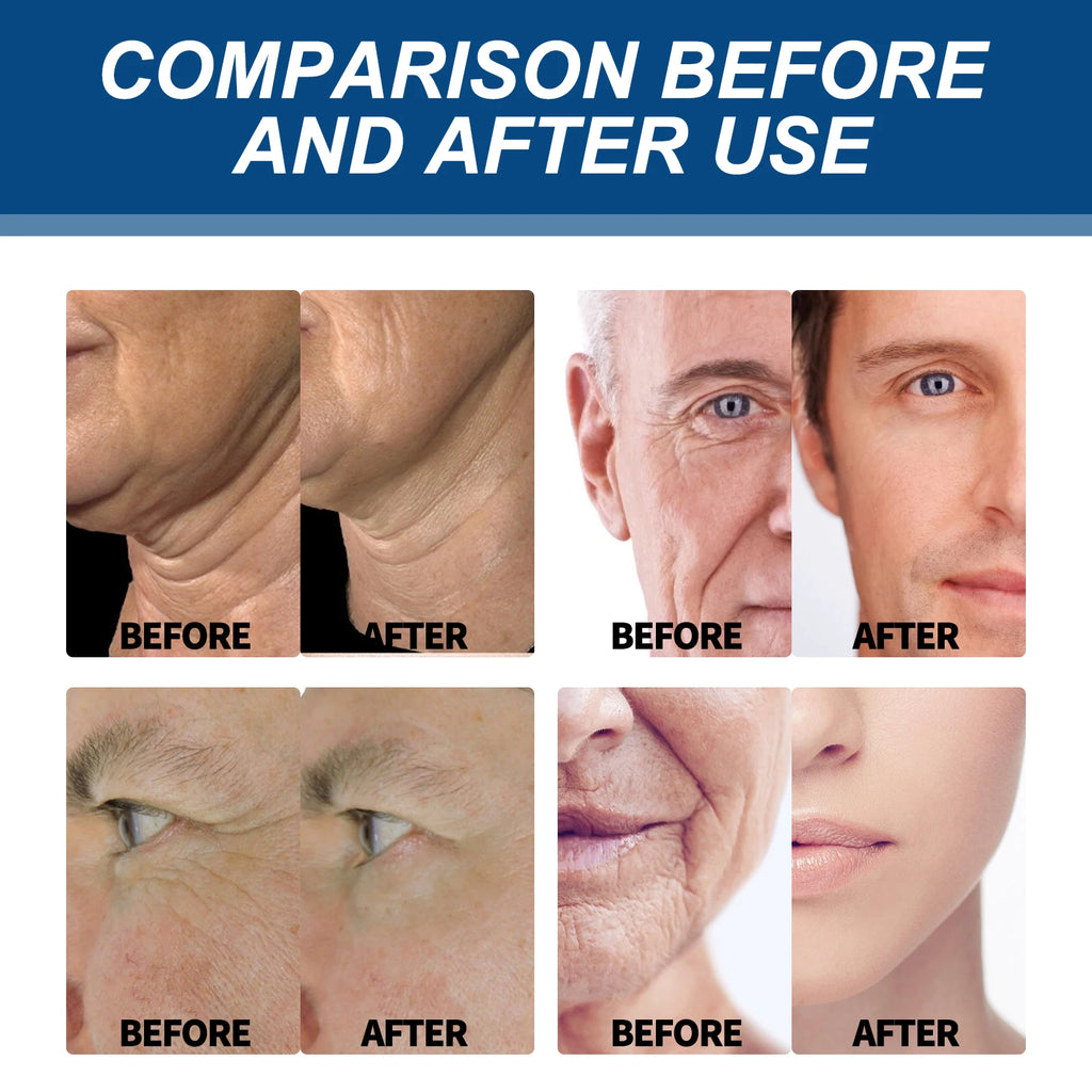 Anti-wrinkle Cream For Men