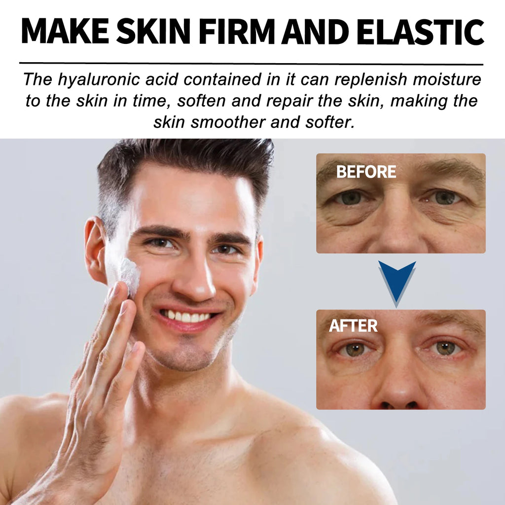 Anti-wrinkle Cream For Men